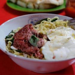 Indomie Rebus Telur Kornet