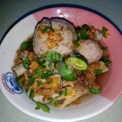 Baso Ranjau Tulang Iga