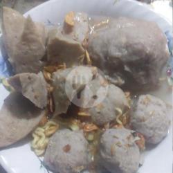 Bakso Campur Jumbo Telur