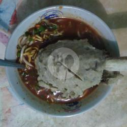 Mie Bakso Bedong (tulang Rusuk)